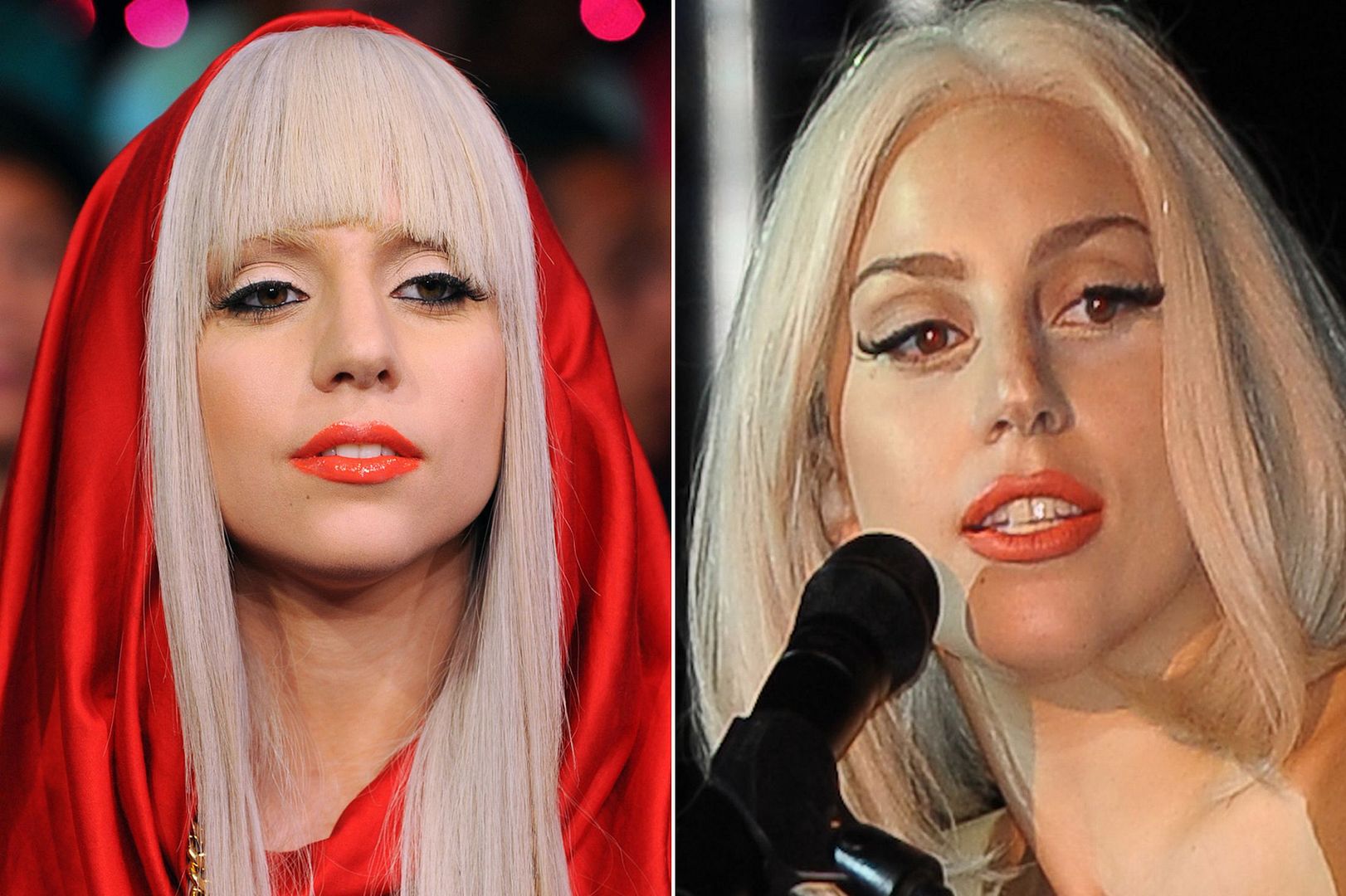 Lady Gaga Plastic Surgery Photos Lady Gaga Plastic Surgery Photos
